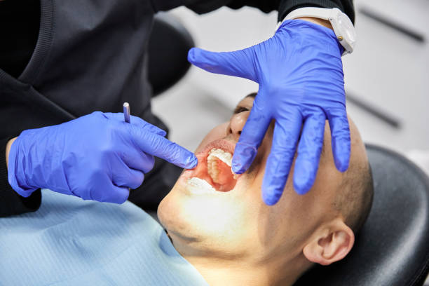 Best Knocked-Out Tooth (Avulsed Tooth) Treatment in New Rochelle, NY